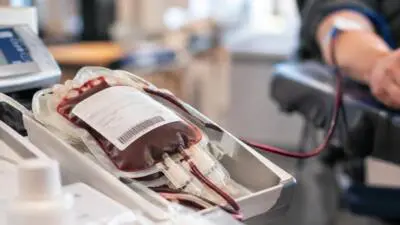 KI-generiertes Bild: Ein Blutbeutel liegt auf einem medizinischen Gerät; Schläuche führen zu einem Arm.