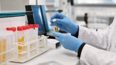 Hände in blauen Einweghandschuhen halten ein Reagenzglas mit gelber Flüssigkeit in einem Labor.